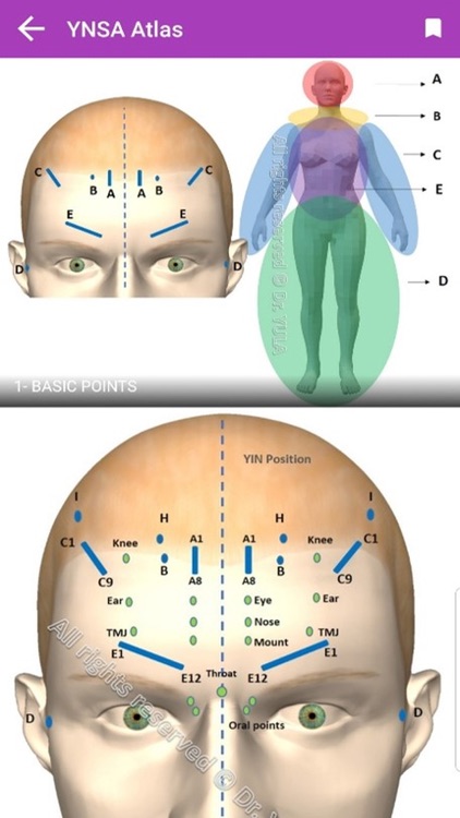 You are currently viewing דיקור קרקפת – YNSA